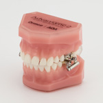 Types of Appliances Austin Westlake TX Orthodontics